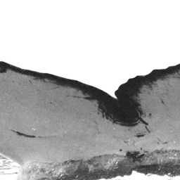 Fluke of CRC-15186
