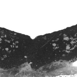Fluke of HW-MN0520614