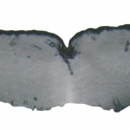 Fluke of ESPHW-MBS#1030