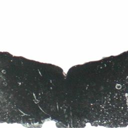 Fluke of ESPHW-MBS#1149