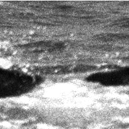 Fluke of TDI-15285