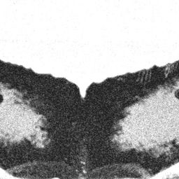 Fluke of BCZ0206