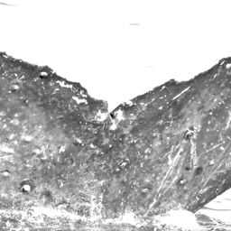 Fluke of Halicoprion