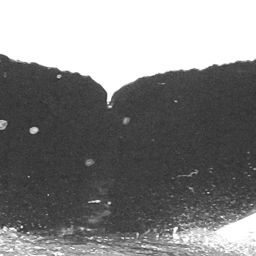 Fluke of CRC-15622